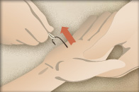 basic_first_aid_removehook03.jpg basic_first_aid_removehook03.jpg